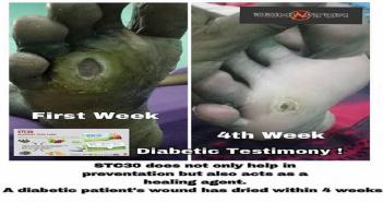 THE POOR DIE BY  THOUSANDS